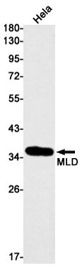 Western blot detection of MLD in Hela cell lysates using MLD Rabbit mAb(1:1000 diluted).Predicted band size:38kDa.Observed band size:38kDa.