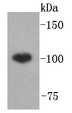Fig1: Western blot analysis of ABCF1 on Hela lysates using anti-ABCF1 antibody at 1/1,000 dilution.