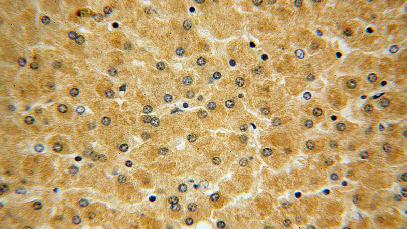 Immunohistochemical of paraffin-embedded human liver using Catalog No:111183(GSTCD antibody) at dilution of 1:100 (under 40x lens)