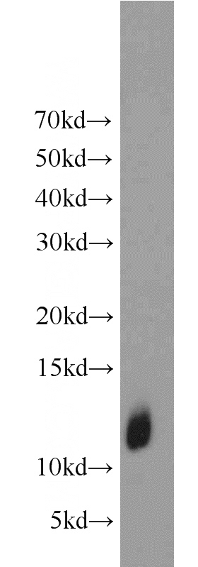 A375 cells were subjected to SDS PAGE followed by western blot with Catalog No:112170(LCE1B antibody) at dilution of 1:1000