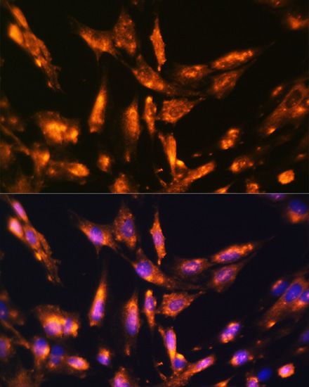 Immunofluorescence - PTCH1 Polyclonal Antibody 