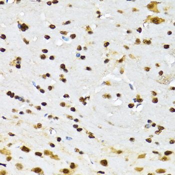 Immunohistochemistry - CCAR2 Polyclonal Antibody 