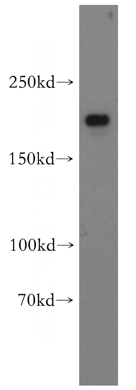 human brain tissue were subjected to SDS PAGE followed by western blot with Catalog No:109431(CNOT1 antibody) at dilution of 1:800