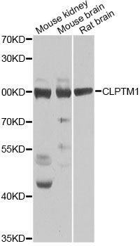 Western blot - CLPTM1 Polyclonal Antibody 