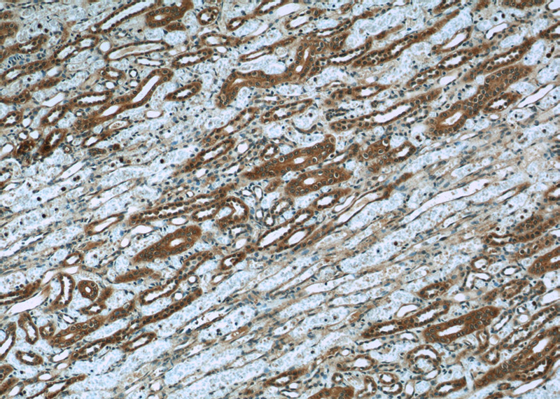 Immunohistochemistry of paraffin-embedded human kidney slide using Catalog No:111824(IQGAP1 Antibody) at dilution of 1:50