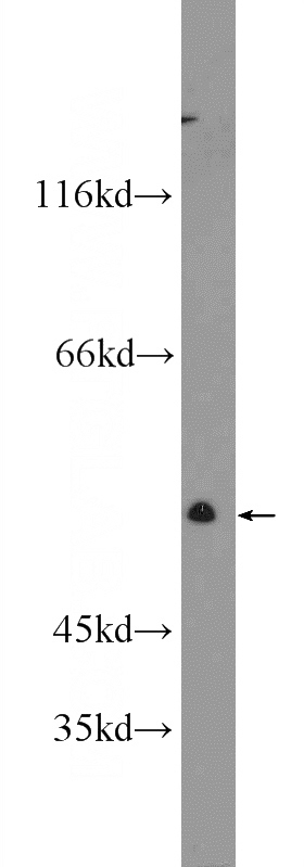 A549 cells were subjected to SDS PAGE followed by western blot with Catalog No:116023(TGFBR1 Antibody) at dilution of 1:300