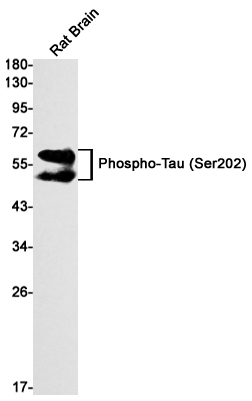 Western blot detection of Phospho-Tau (Ser202) in Rat Brain lysates using Phospho-Tau (Ser202) Rabbit mAb(1:1000 diluted).Predicted band size:79kDa.Observed band size: 50-80kDa.