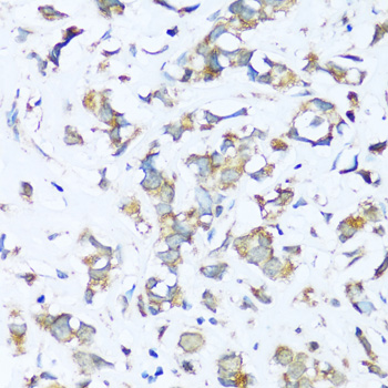 Immunohistochemistry - ATP5I Polyclonal Antibody 