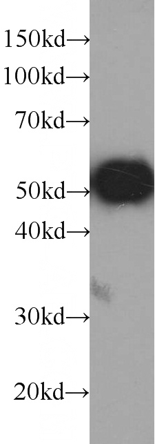 Recombinant protein were subjected to SDS PAGE followed by western blot with HRP-66002(GFP tag Antibody) at dilution of 1:10000