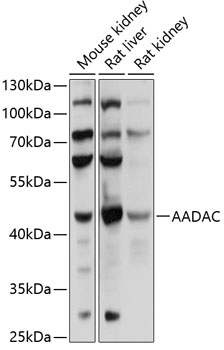 Western blot - AADAC Polyclonal Antibody 