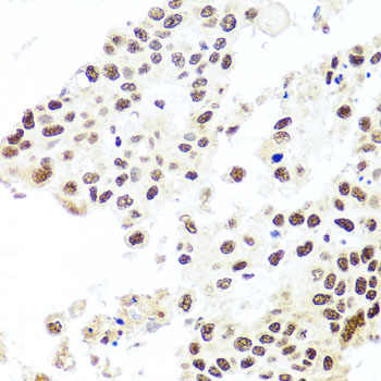 Immunohistochemistry - HIRA Polyclonal Antibody 