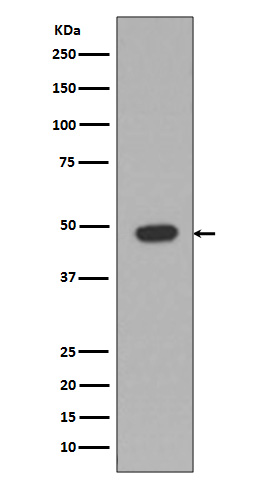 Western blot analysis of GFAP expression in Rat brain lysate.