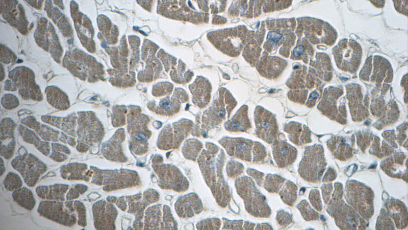 Immunohistochemistry of paraffin-embedded human heart tissue slide using Catalog No:115032(SDHB Antibody) at dilution of 1:50 (under 40x lens)