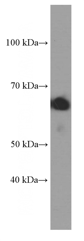 K-562 cells were subjected to SDS PAGE followed by western blot with Catalog No:107611(STXBP2 Antibody) at dilution of 1:4000