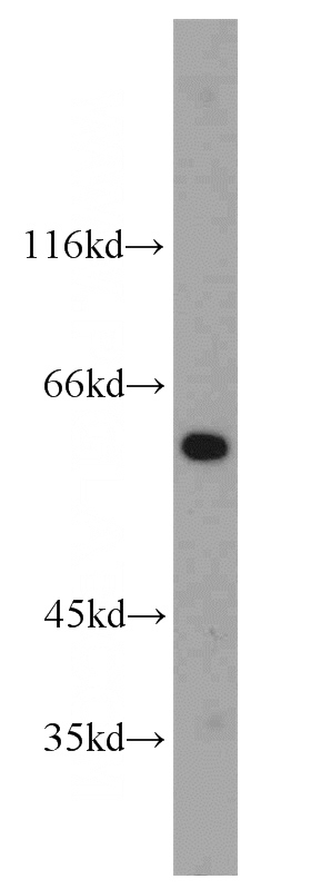 human liver tissue were subjected to SDS PAGE followed by western blot with Catalog No:111350(HINFP antibody) at dilution of 1:300