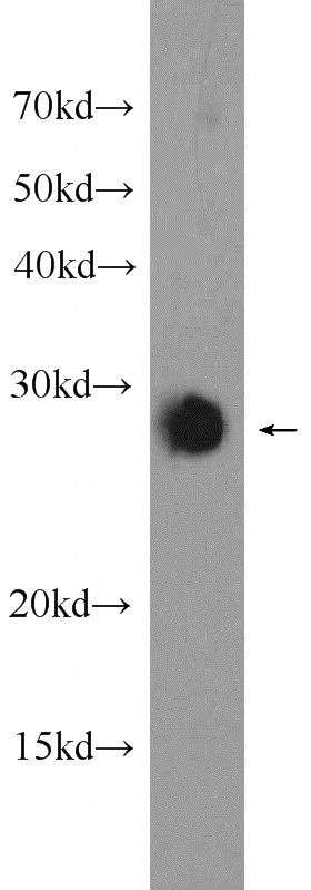 rat brain tissue were subjected to SDS PAGE followed by western blot with Catalog No:112236(LIN7A Antibody) at dilution of 1:1000
