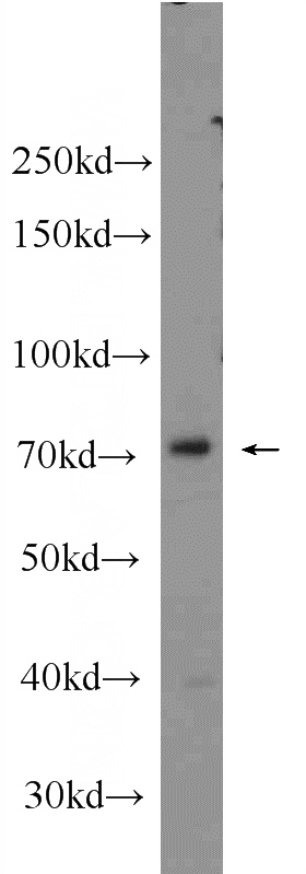 K-562 cells were subjected to SDS PAGE followed by western blot with Catalog No:114230(PRPF39 Antibody) at dilution of 1:1000