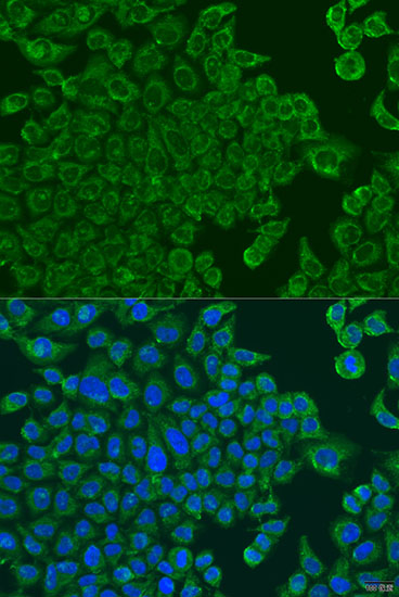 Immunofluorescence - ALOXE3 Polyclonal Antibody 