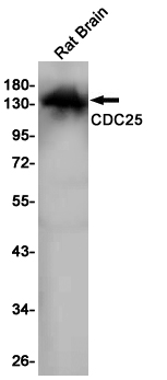 Western blot detection of CDC25 in Rat Brain lysates using CDC25 Rabbit pAb(1:1000 diluted).Predicted band size:145KDa.Observed band size:145KDa.