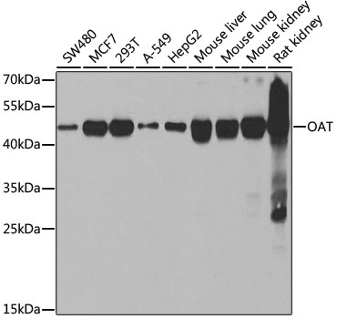 Western blot - OAT Polyclonal Antibody 