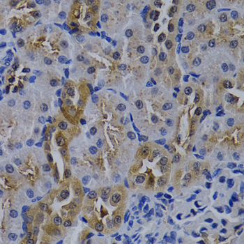 Immunohistochemistry - TNFRSF6B Polyclonal Antibody 