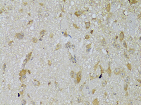 Immunohistochemistry - TSHR Polyclonal Antibody 