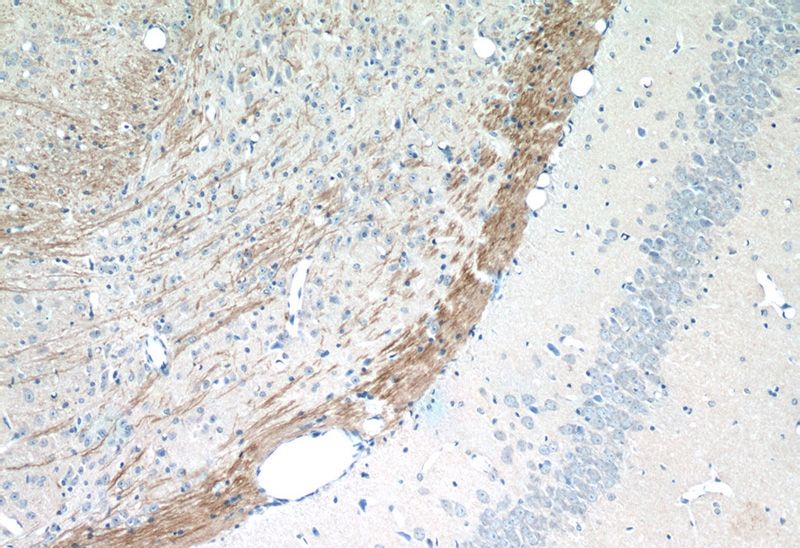 Immunohistochemistry of paraffin-embedded mouse brain tissue slide using Catalog No:109777(DDRGK1 Antibody) at dilution of 1:50 (under 10x lens)