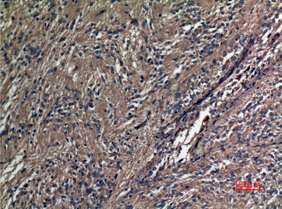 Immunohistochemical analysis of paraffin-embedded human-ovary, antibody was diluted at 1:100