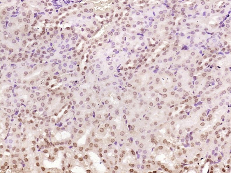 Fig2: Paraformaldehyde-fixed, paraffin embedded (Mouse kidney); Antigen retrieval by boiling in sodium citrate buffer (pH6.0) for 15min; Block endogenous peroxidase by 3% hydrogen peroxide for 20 minutes; Blocking buffer (normal goat serum) at 37℃ for 30min; Antibody incubation with (NADPH oxidase 4) Polyclonal Antibody, Unconjugated at 1:400 overnight at 4℃, followed by operating according to SP Kit(Rabbit) (sp-0023) instructions and DAB staining.