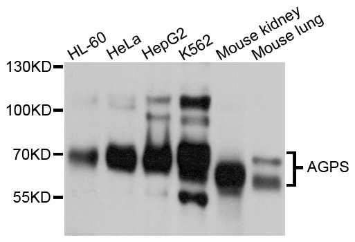 Western blot - AGPS Polyclonal Antibody 