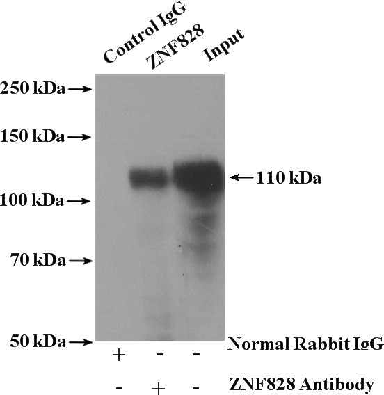 IP Result of anti-ZNF828 (IP:Catalog No:117250, 4ug; Detection:Catalog No:117250 1:1000) with Jurkat cells lysate 4000ug.