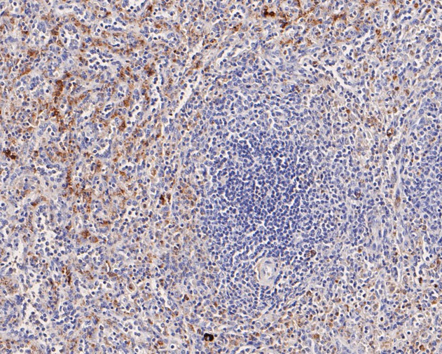 Fig3:; Immunohistochemical analysis of paraffin-embedded human spleen tissue using anti-CD68 antibody. The section was pre-treated using heat mediated antigen retrieval with Tris-EDTA buffer (pH 8.0-8.4) for 20 minutes.The tissues were blocked in 5% BSA for 30 minutes at room temperature, washed with ddH; 2; O and PBS, and then probed with the primary antibody ( 1/200) for 30 minutes at room temperature. The detection was performed using an HRP conjugated compact polymer system. DAB was used as the chromogen. Tissues were counterstained with hematoxylin and mounted with DPX.