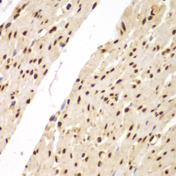 Immunohistochemistry - SUPT20H Polyclonal Antibody 