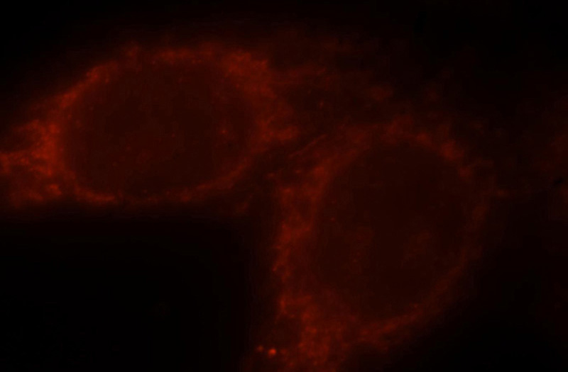 Immunofluorescent analysis of HepG2 cells, using PI4K2B antibody Catalog No:113877 at 1:25 dilution and Rhodamine-labeled goat anti-rabbit IgG (red).