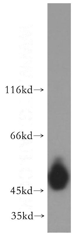 A431 cells were subjected to SDS PAGE followed by western blot with Catalog No:109792(KRT14 antibody) at dilution of 1:1000