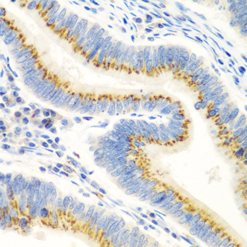 Immunohistochemistry - UBIAD1 Polyclonal Antibody 