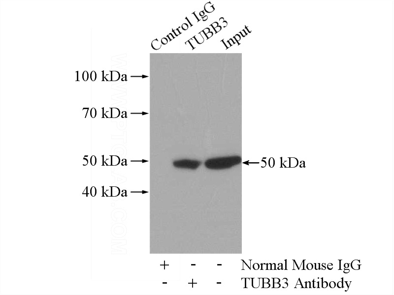 IP Result of anti-Tubulin-beta (IP:Catalog No:117308, 5ug; Detection:Catalog No:117308 1:1000) with HeLa cells lysate 880ug.