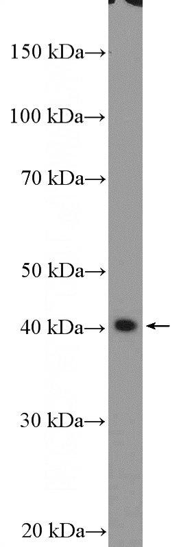 mouse colon tissue were subjected to SDS PAGE followed by western blot with Catalog No:113764(PDCD2L Antibody) at dilution of 1:300
