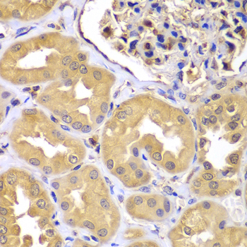 Immunohistochemistry - LZTR1 Polyclonal Antibody 