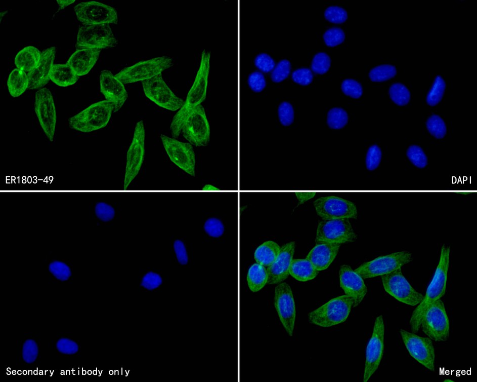 Fig2: ICC staining CACNA1C in SKOV-3 cells (green). The nuclear counter stain is DAPI (blue). Cells were fixed in paraformaldehyde, permeabilised with 0.25% Triton X100/PBS.