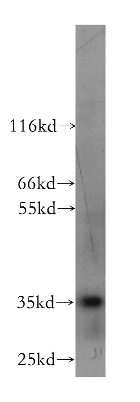 SH-SY5Y cells were subjected to SDS PAGE followed by western blot with Catalog No:107184(CXCL16 antibody) at dilution of 1:300