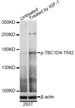 Western blot - Phospho-TBC1D4-T642 pAb 