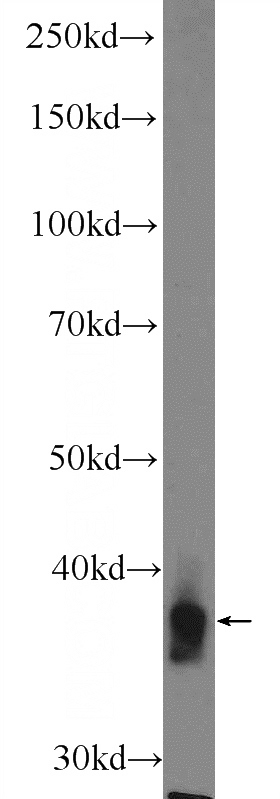 Jurkat cells were subjected to SDS PAGE followed by western blot with Catalog No:114343(PVRIG Antibody) at dilution of 1:600