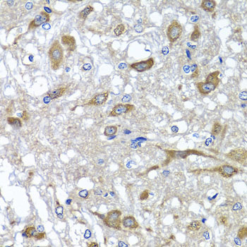 Immunohistochemistry - OSGEPL1 Polyclonal Antibody 