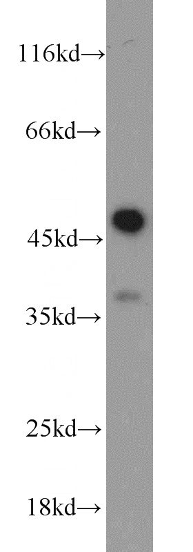 Jurkat cells were subjected to SDS PAGE followed by western blot with Catalog No:108870(CASP1 antibody) at dilution of 1:1000