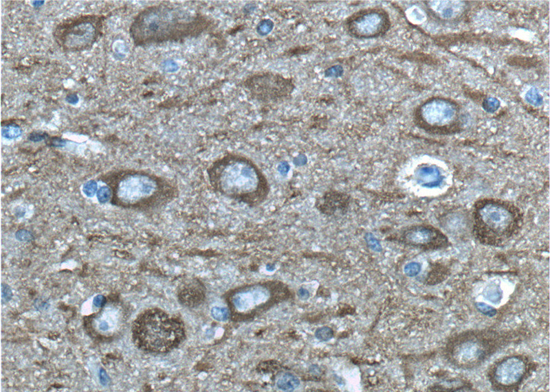 Immunohistochemistry of paraffin-embedded human brain tissue slide using Catalog No:113287(ENO2 Antibody) at dilution of 1:200 (under 40x lens)