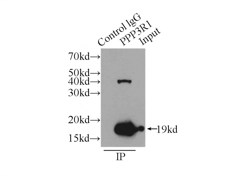 IP Result of anti-PPP3R1 (IP:Catalog No:114114, 3ug; Detection:Catalog No:114114 1:300) with HeLa cells lysate 5000ug.