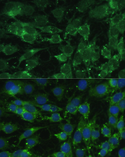 Immunofluorescence - BLOC1S3 Polyclonal Antibody 