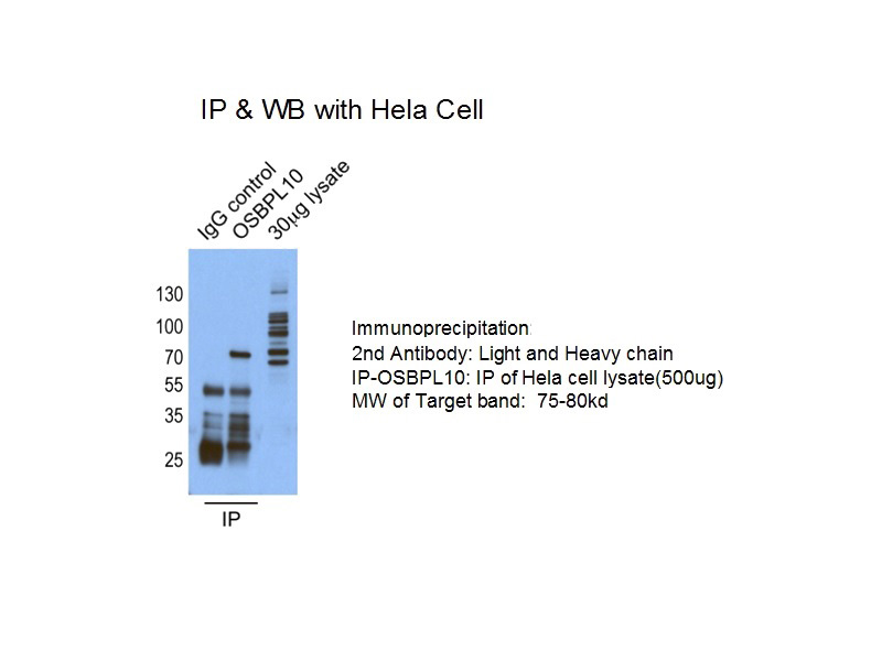 IP result of anti-OSBPL10(Catalog No:113429 for IP and Detection).