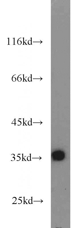 mouse pancreas tissue were subjected to SDS PAGE followed by western blot with Catalog No:116260(PLAT antibody) at dilution of 1:1000